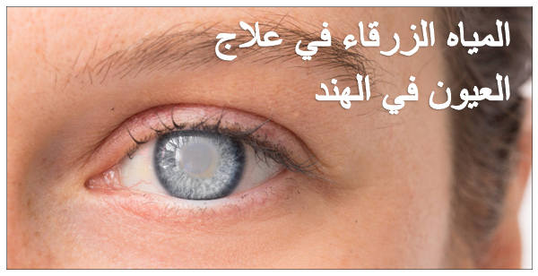 المياه-الزرقاء-في-علاج-العيون-في-الهند