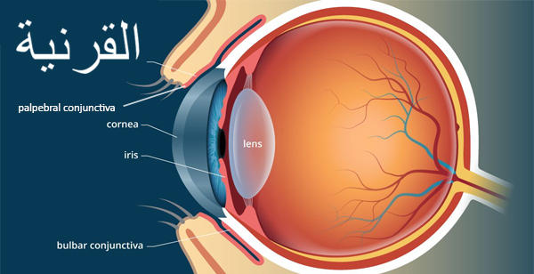 جراحة-القرنية-في-الهند