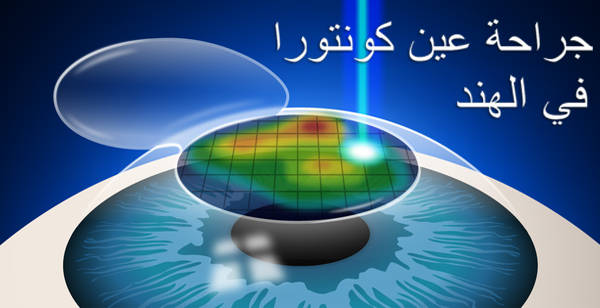 جراحة-عين-كونتورا-في-الهند