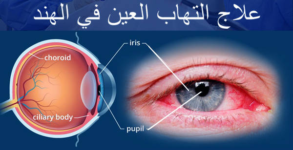 علاج-التهاب-العين-في-الهند