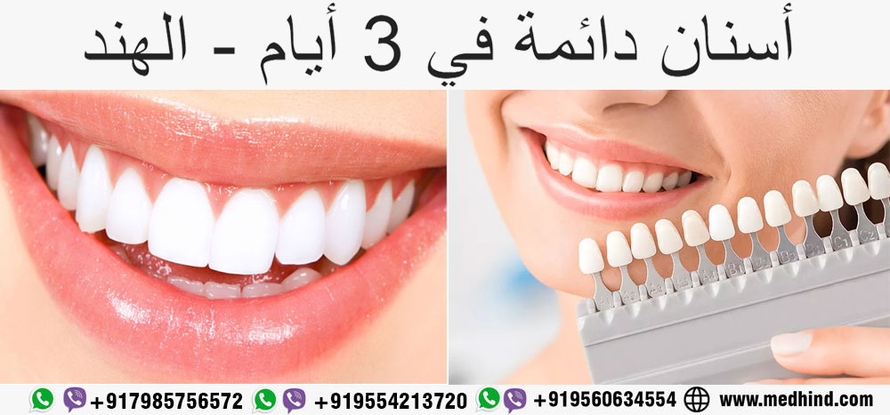 أسنان-دائمة-في-3-أيام---الهند