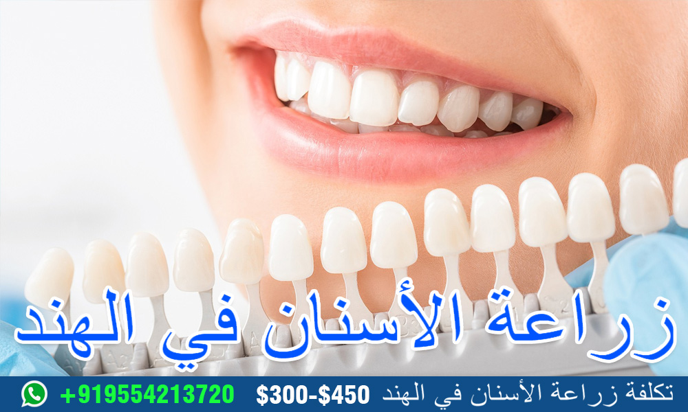 زراعة-الأسنان-في-الهند زراعة-الأسنان-في-الهند
