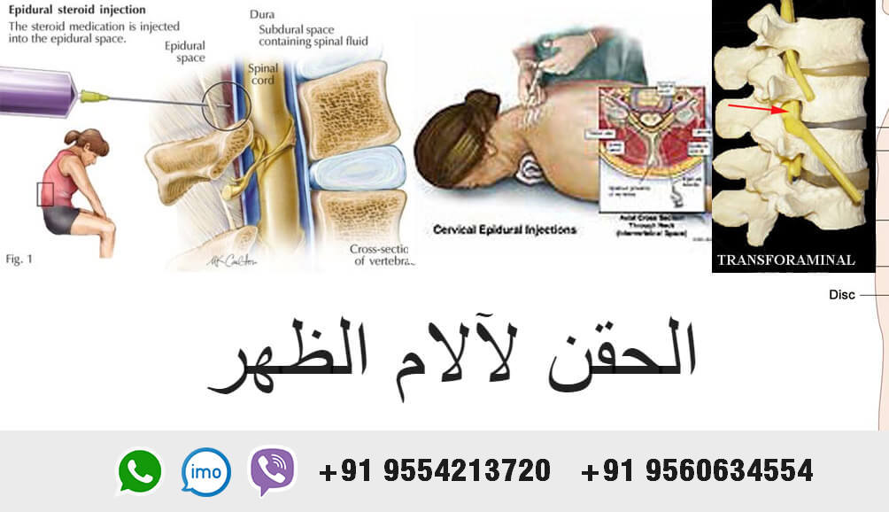 Injections for back pain