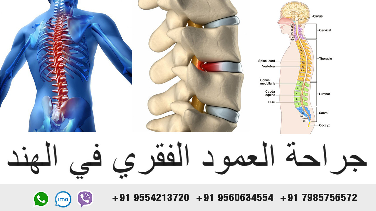 Spine-surgery-in-india-best-spine-surgery-in-india