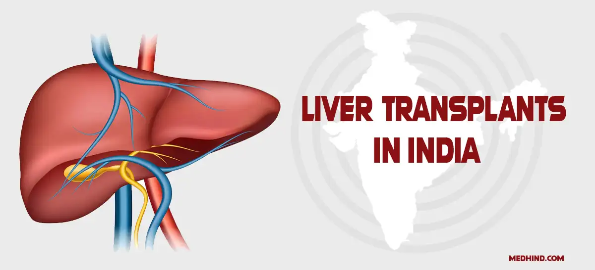 Live-Transplant-in-India