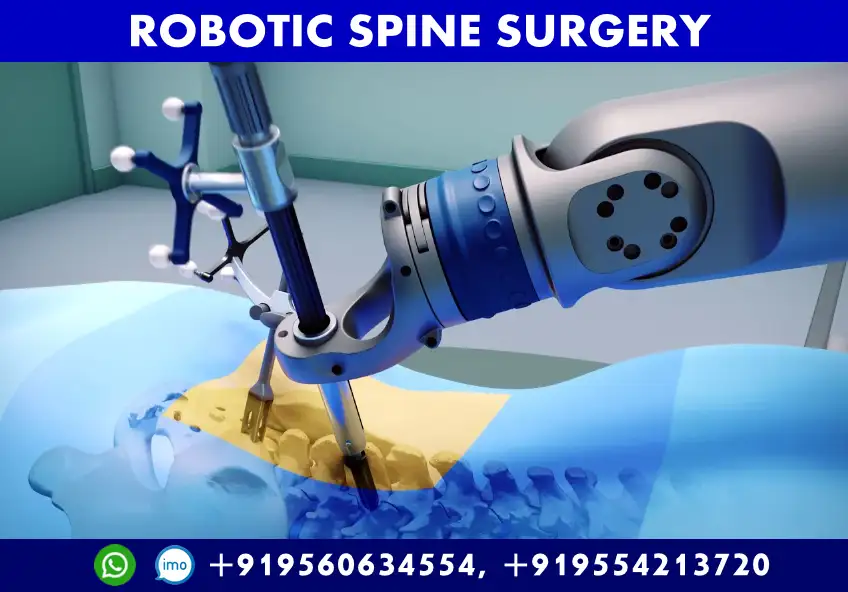 جراحة العمود الفقري الروبوتية في الهند