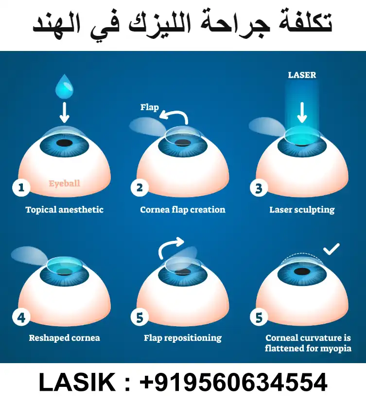 جراحة الليزك في الهند