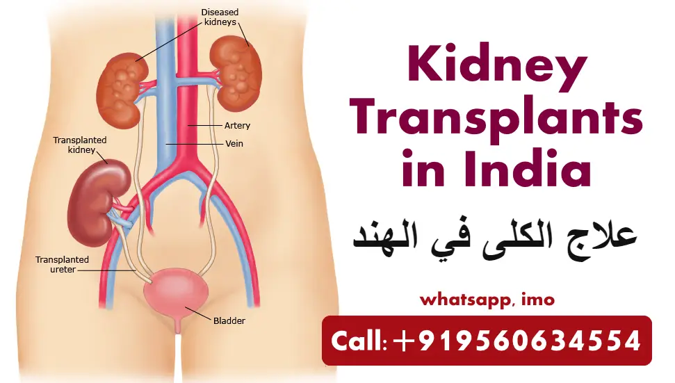 علاج الكلى في الهند